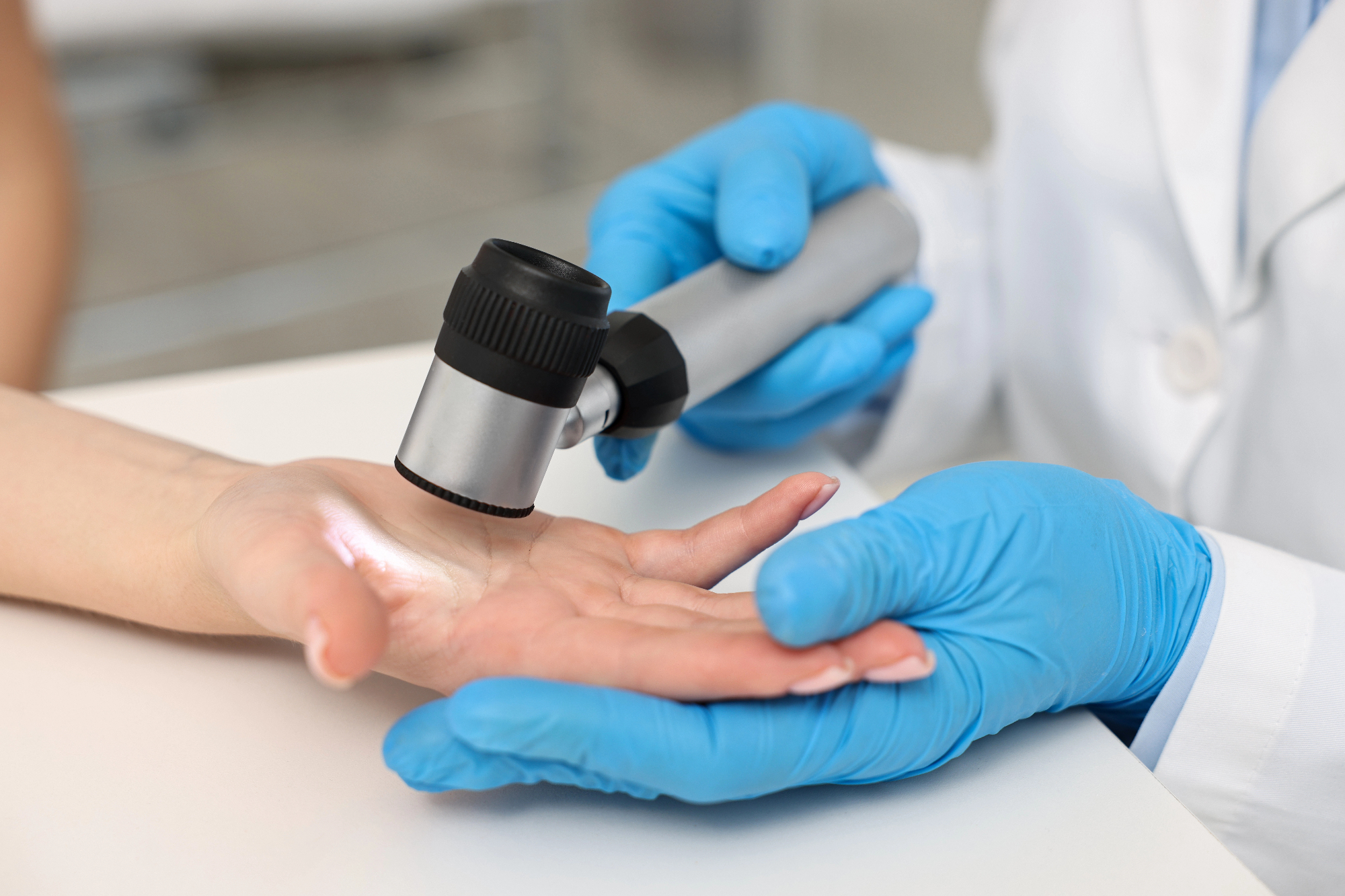 Dermatologija Ljubljana: Zgodba o tem, kako imam tudi jaz končno lepo kožo